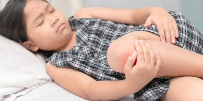 Diagnosis and Treatment of Juvenile Arthritis