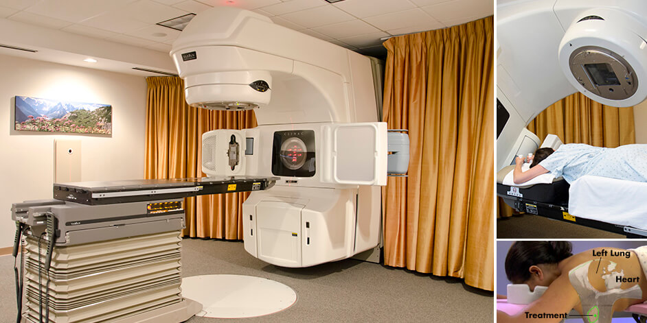 Prone Breast Radiation Therapy at IGRT